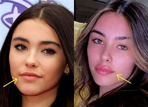 Madison Beer shows “proof” she didn’t have plastic ...